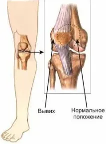 става колянната