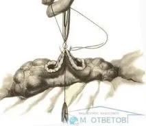 възможни усложнения
