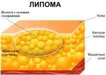могат бъдат мазнини
