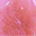 ABRADERMOL мікродермабразійний крем - Sesderma Mediderma - хімічні пілінги,професійна sesderma
