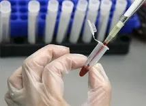 Аналіз крові при туберкульозі захворювання