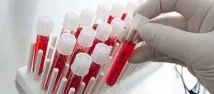 Аналіз крові на токсоплазмоз Як здавати та розшифрувати результат токсоплазмоз
