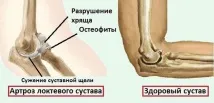 става