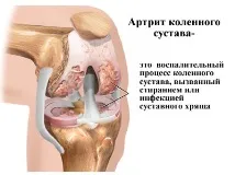 коліна
