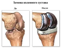 коліна