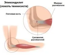 лечение