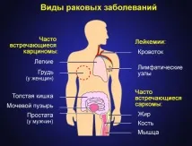 Болі в правому кульшовому суглобі причини, симптоми, лікування правому