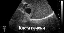 какво какво