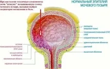 Цисталгія у жінок симптоми та лікування цисталгія