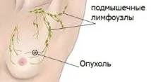 Доксициклін продовжує життя продовжує