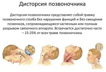 Дисторсія хребта (шийного відділу, поперекового). поперекового
