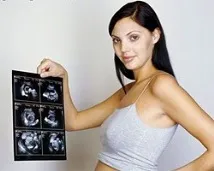 Щоденник майбутньої мами Планове УЗД, Спільноти, AskWoman планове