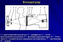 Доза опромінення при рентгені допустима для людини та дітей рентгені