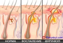 причини устни