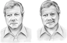 исхемичен симптоми