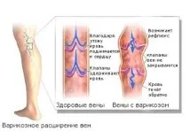 лікування