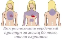 разпознаем случи
