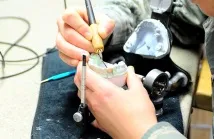 Коронки на зуби на жувальні різновиди та етапи встановлення коронки