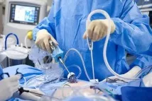 Лапароскопія – з чого складається вартість вартість