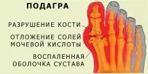 лечение дома