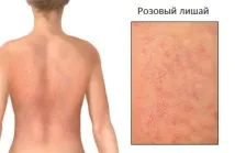 лишаване особености