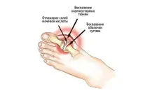 лікування