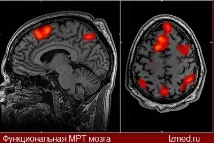 МРТ в Ізраїлі для іноземних пацієнтів у питаннях та відповідях питаннях