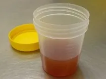 осадком