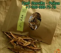 открие туберкулоза