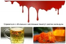 Рясна менструація – причини, лікування, рекомендації лікаря лікаря