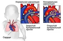 патентен деца