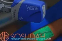 плетизмография долните