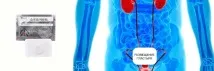 Пластир ZB Prostatic Navel Plaster для чоловіків, інструкція застосування navel