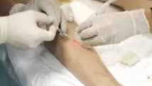 краката след