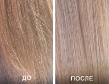 какво техника