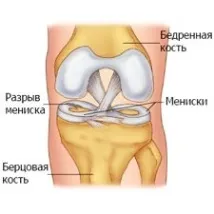 колянната