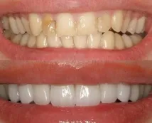 цени личен