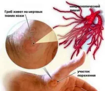 деца розов