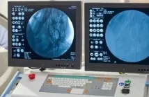 Селективна ангіографія суть, види та переваги методу обстеження ангіографія