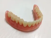 липса зъби липса зъби