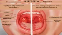 кашель