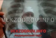 система нервна