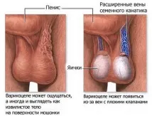 малкия