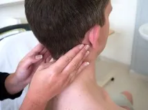 лімфовузлів