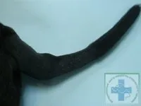 хірургічне