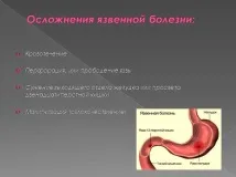 Виразка шлунка симптоми та прояв - докладна інформація прояв