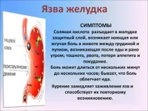 Виразка шлунка симптоми та прояв - докладна інформація докладна