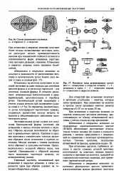 газа