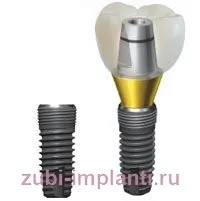 implantium implantium