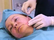 конци златни